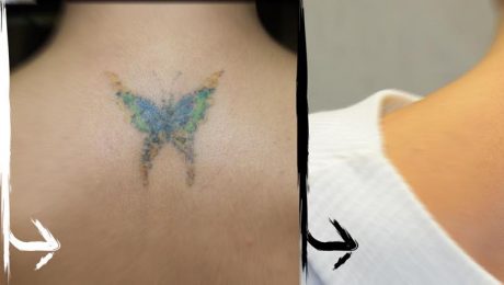 21_baterfly